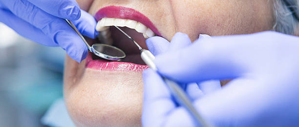 Best Emergency Wisdom Tooth Extraction in Holtville, AL